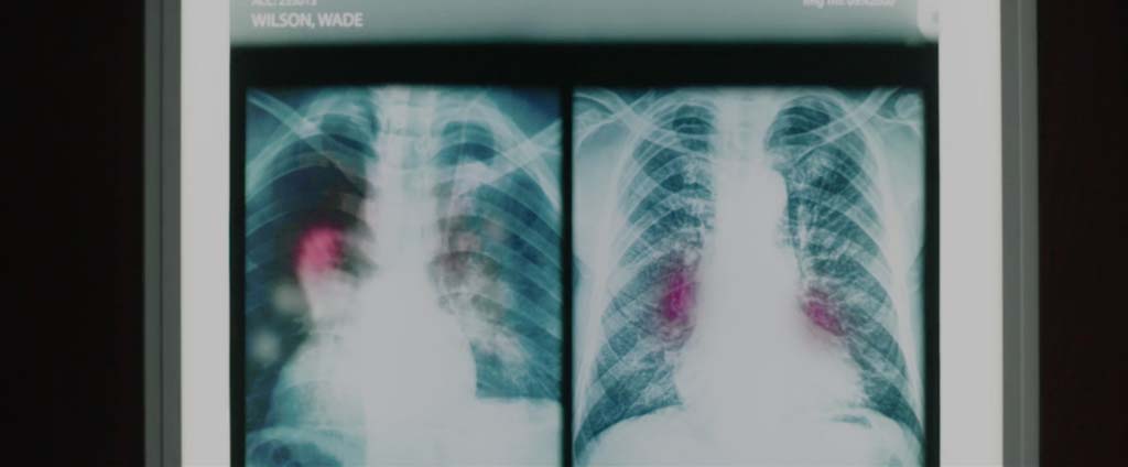 Deadpool Movie Screenshot Cancer